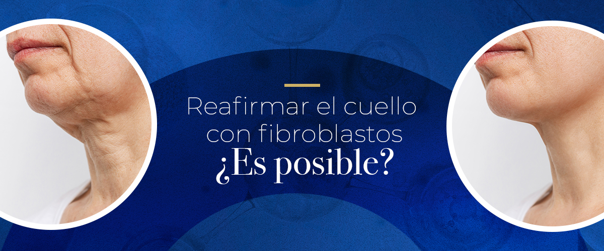 Reafirmar el cuello con fibroblastos ¿es posible?