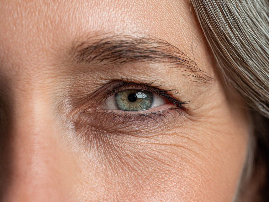 ¿Cómo quitar las ojeras? ¡Prueba con fibroblastos!